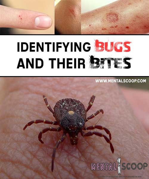 identifying bed bug bites identifying bugs and their bites mental scoop identifying bed bug bites identifying bugs and their bites mental scoop