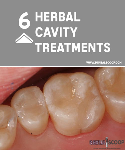 or doctor mouth problem dentist Herbal Treatments Scoop Cavity 6 Mental or doctor mouth problem dentist Herbal Treatments Scoop Cavity 6 Mental